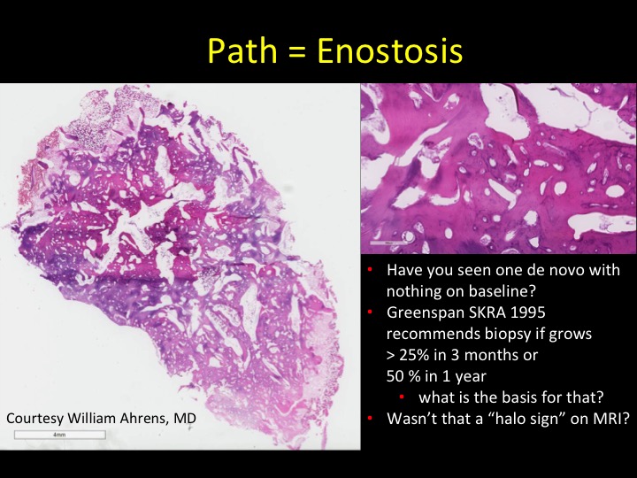 Figure 6 for case bone island ( RID4004 )